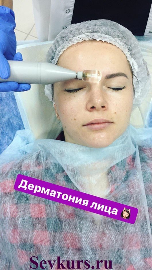 Практическое занятие на тему: "Дерматония лица".